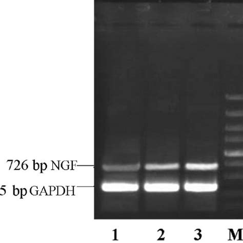 Plasmid vectors used in this study. A. Vector pEGFP-C1. B. Expression ...
