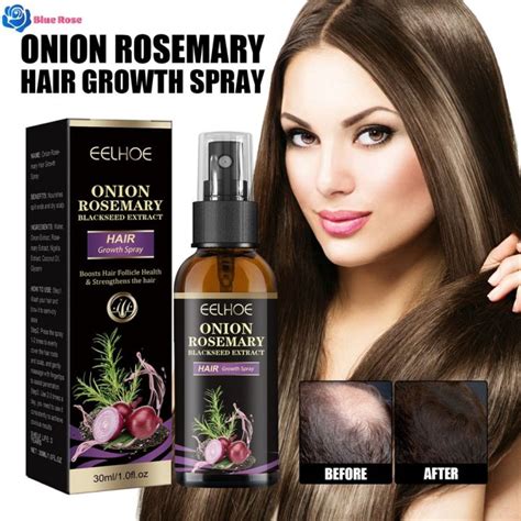 Blue Rose EELHOE Onion Rosemary Hair Growth Spray Strong Hair