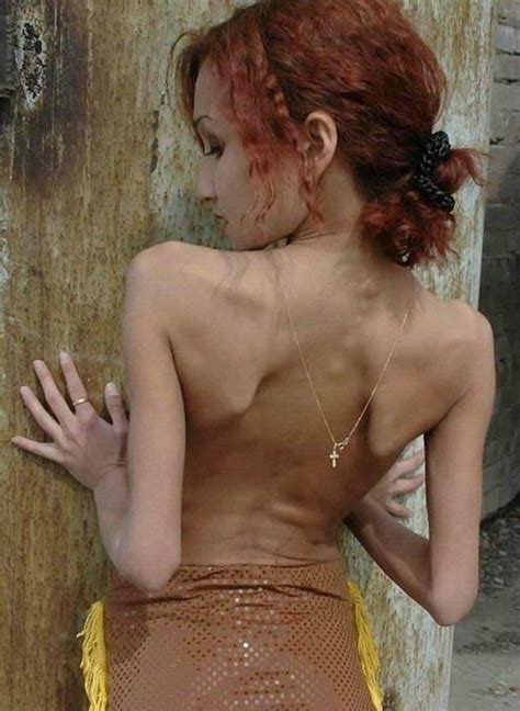 Very Skinny Amateur Girls Poser Porn Pictures XXX Photos Sex Images 2692707 PICTOA