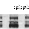 Expression Of Trkb Full Fl And Truncated T Isoforms In The