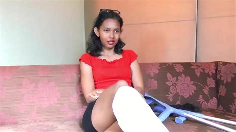 Free Leg Cast Porn Videos XHamster