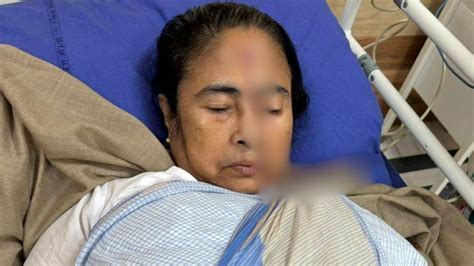 पश्चिम बंगाल की Cm ममता बनर्जी को सिर पर लगी चोट अस्पताल में हुईं भर्ती West Bengal Cm Mamata