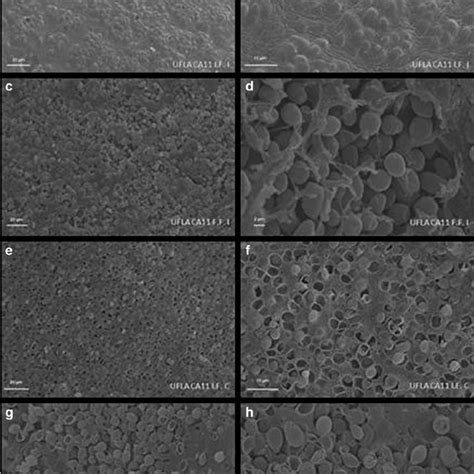 Scanning electron micrographs of the surface (a, b, c, and d) and inner ...