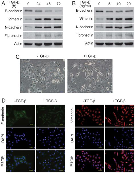 Bufalin Inhibits Tgf β Induced Epithelial To Mesenchymal Transition And