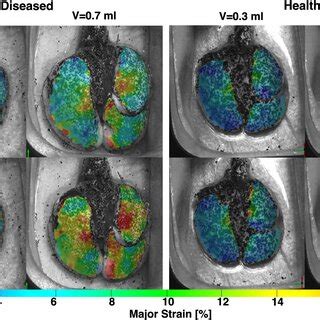 Representative Murine Diseased And Healthy Lungs Topological Major