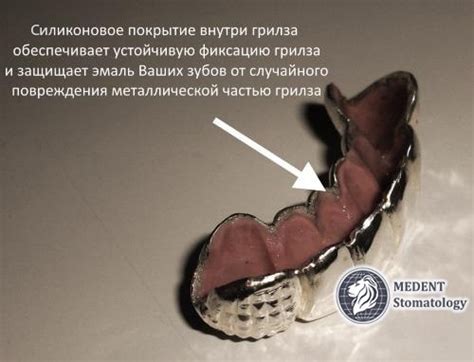 Как грилз держится на зубах? | ВКонтакте