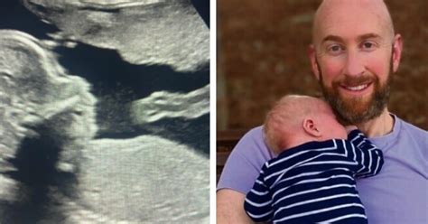 Uomo Gay Fa La Storia Per Essere Diventato Padre Tramite Una Maternit Surrogata