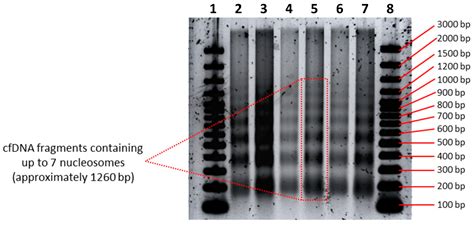 Diagnostics Free Full Text Cell Free Dna Fragmentation Patterns In