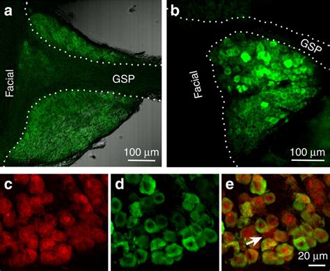 Geniculate Ganglia From GCaMP3 Mice Express Ca2 Reporter In Nearly