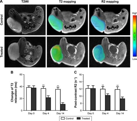 Full Article Noninvasive Monitoring Of Early Antiangiogenic Therapy