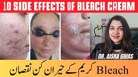 10 Side Effects Of Bleach Cream On Face Does Bleaching Cream Work