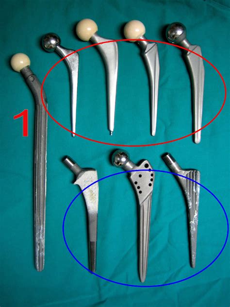 Tipos De Protesis De Cadera