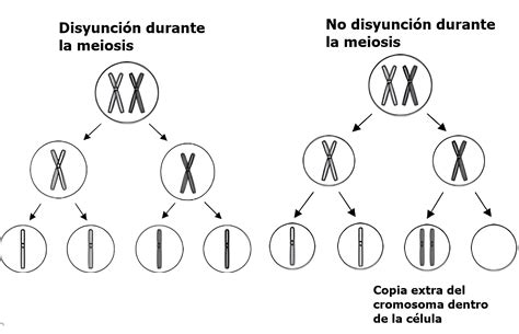 Guía del síndrome de Klinefelter: Causas, Síntomas, Diagnóstico