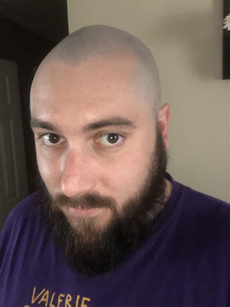 Felt Hot And Shaved My Head R Bald