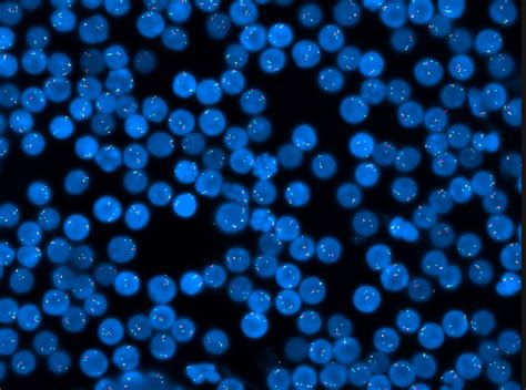 Cyto FISH Structural Analysis Sapiens Genetics Laboratory