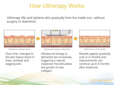 Ultherapy 超声刀 Neuglow The Aesthetic Doctors Skin Face And Hair