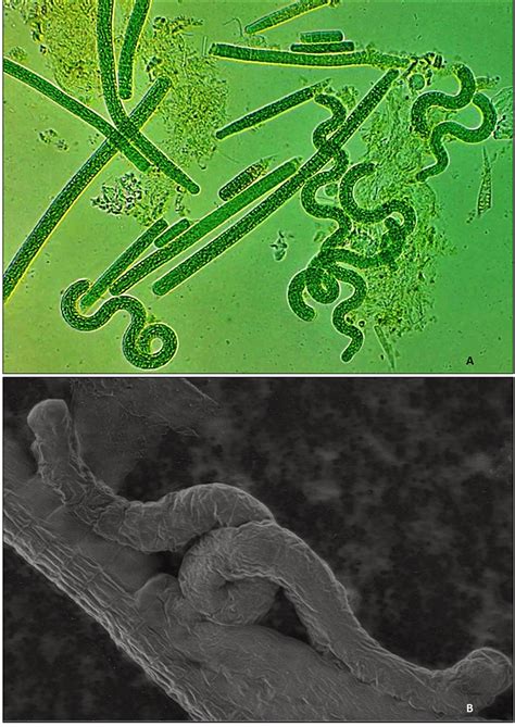 A Prominent Superfood: Spirulina platensis | IntechOpen