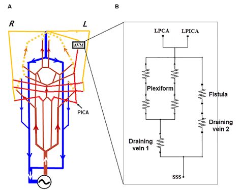 Figure From Patient Specific Blood Flow Analysis For Cerebral