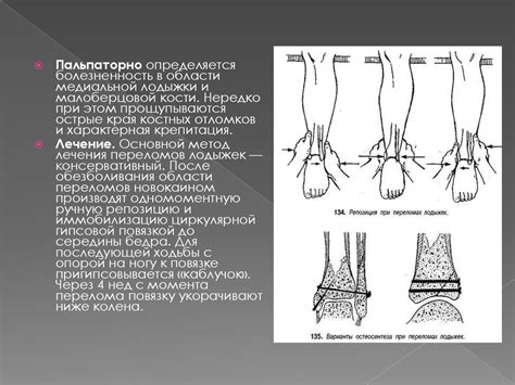 Травмы нижних конечностей - презентация онлайн