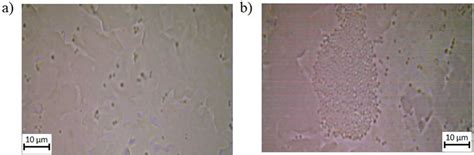 Light microscope images of S. epidermidis on surfaces. (a) A 100x ...