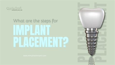 Implant Placement Coral Gables Florida