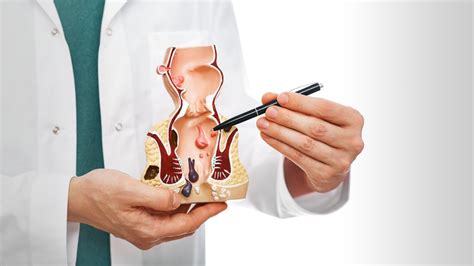 Anal ve Rektal Hastalıklar Medisafe