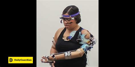 Researchers Develop Bionic Arm That Restores Natural Behaviors In Upper