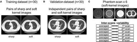 Frontiers Kernel Conversion For Robust Quantitative Measurements Of