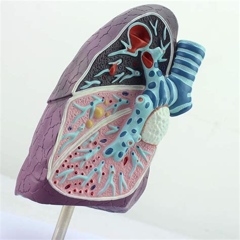 Buy Anatomical Lung Model Smokers Pathological Tuberculosis