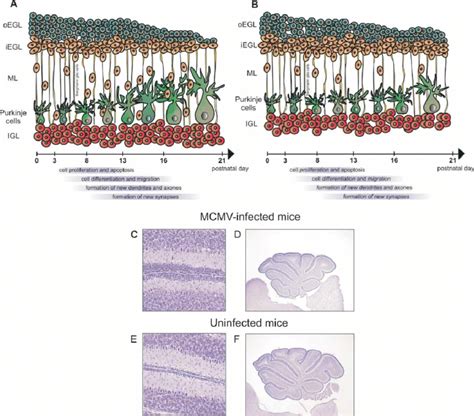 Postnatal Cerebellum Development In Newborn Mice Is Impaired During