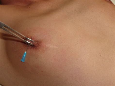 Extreme Amateur Needle Pain And Nipple Piercing Tortures Of European Painslut Pu Porn Pictures