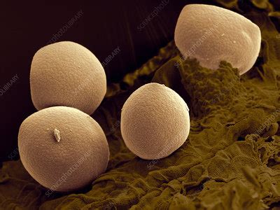 SEM Of Grass Sorghum Pollen Stock Image B786 1023 Science Photo