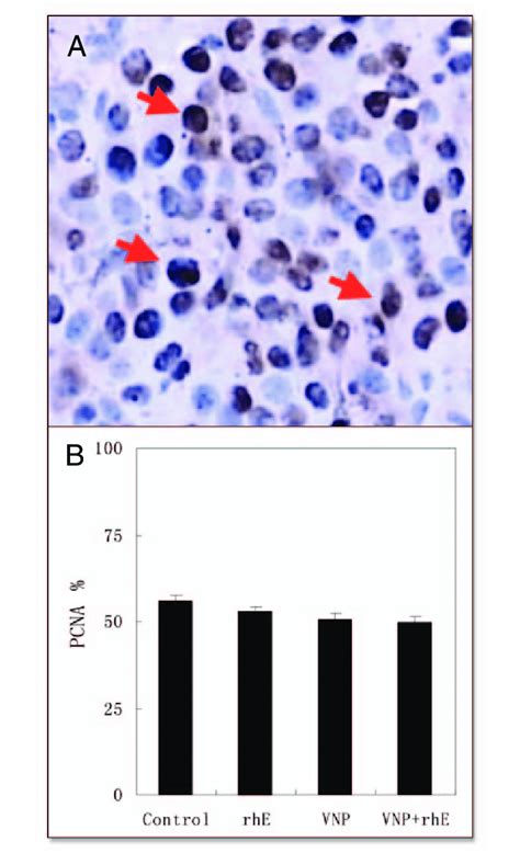 Tumor Cell Proliferation Analysis Pcna Staining Was Performed With Download Scientific Diagram