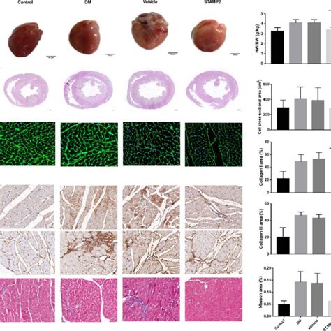 STAMP2 Alleviated Myocardial Fibrosis In Diabetic Hearts A General