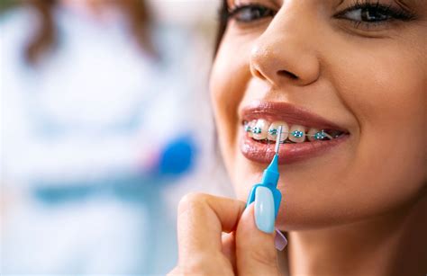 La Importancia De La Higiene Interdental Para Una Sonrisa Radiante Y Un