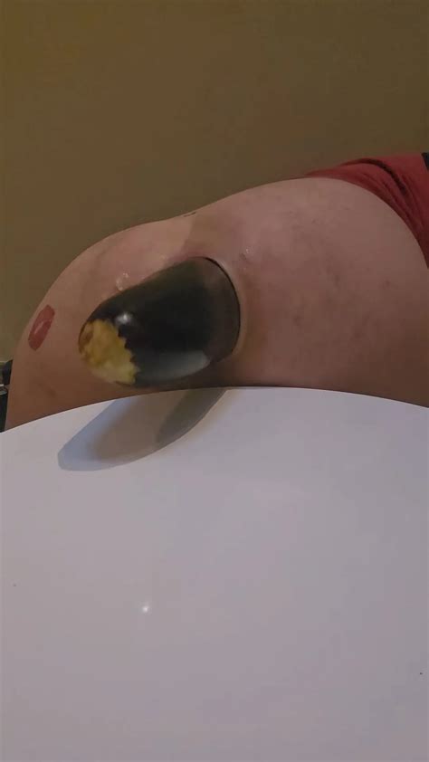 Massive Eggplant Gaping My Asshole Wide 19 Nude Pics XHamster