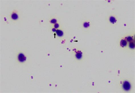 Budding Yeast Gram Stain