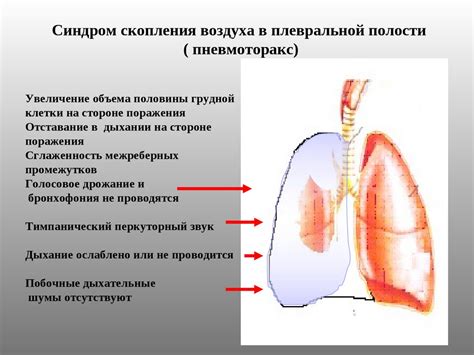 Синдромы при заболеваниях органов дыхания - презентация онлайн