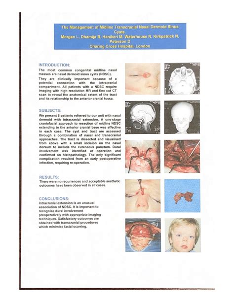 Pdf The Management Of Midline Transcranial Nasal Dermoid Sinus Cysts