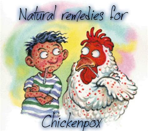 Natural Remedies for Chickenpox - Raising Toxin Free Children