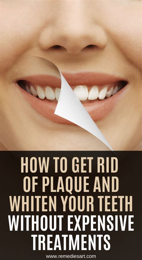 How To Get Rid Of A Gap In Your Teeth At Home How To Whiten Your