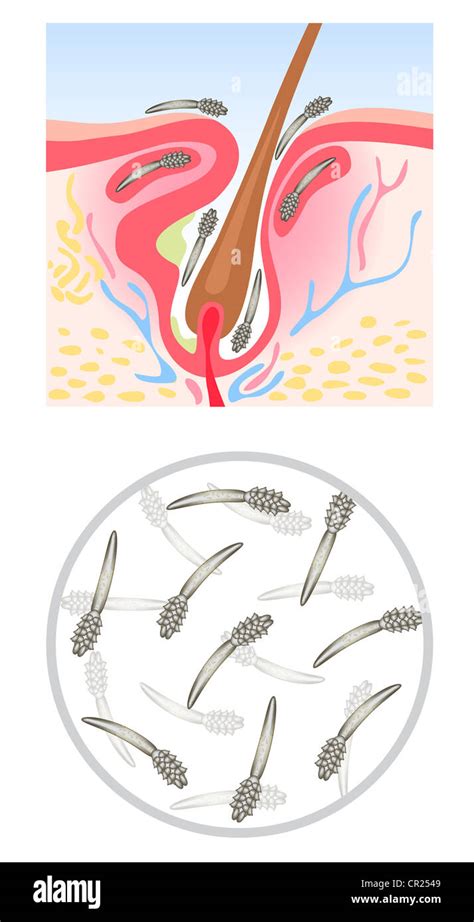 Demodicosis (Demodex), also called demodectic mange or red mange ...