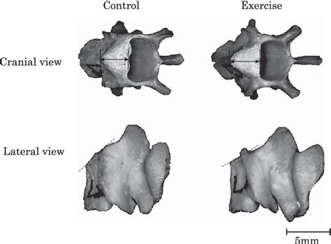 Lumbar Vertebrae L