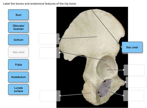 [solved] Label The Bones And Anatomical Features Of The Hip Bone