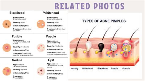 skin anatomy  human skin layers  skin