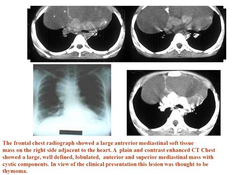 The Image Above Illustrates An Nadh Tr Stain Showing Dark Type And