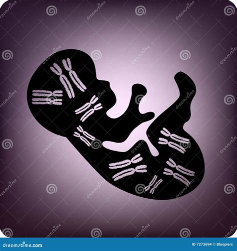 Chromosomes 21, Trisomy 21, Down Syndrome. Concept Royalty-Free Stock