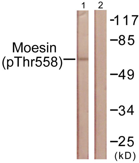 Moesin Ezrin Radixin Antibody Phospho Thr Oaaf