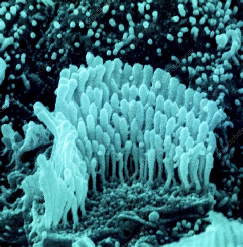 human ear hair cell sem stock image  science photo library