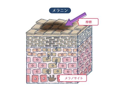 お腹にできた茶色いシミの原因は摩擦？ほかの病気の可能性も！？ ハダメディア By Bihadadotokyo